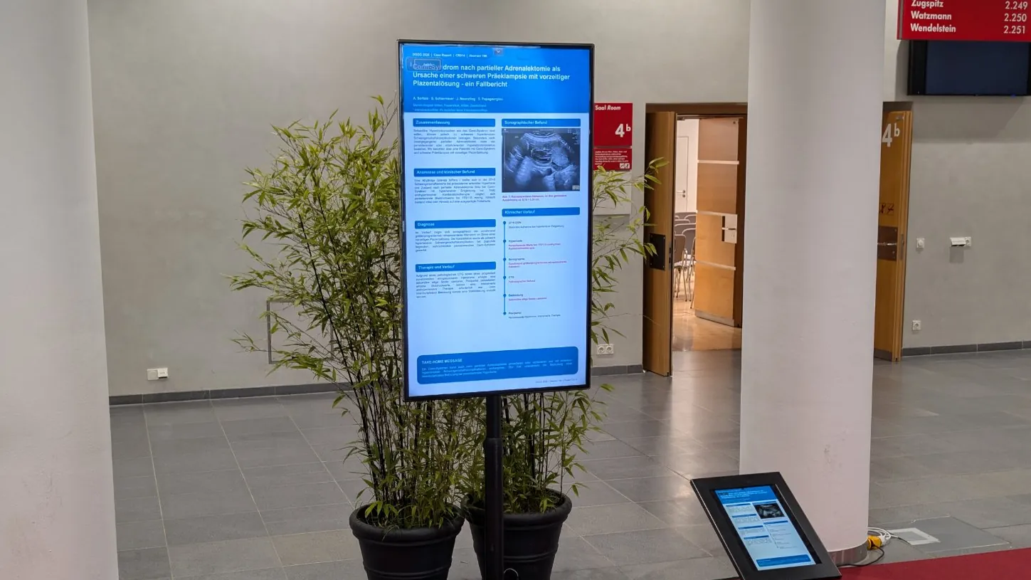 ePoster-Station im Kongressfoyer mit wissenschaftlichem Poster auf großem Bildschirm und Tablet-Pult